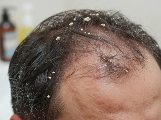 Co znamenají strupy ve vlasech? Příčiny a jak s nimi zacházet