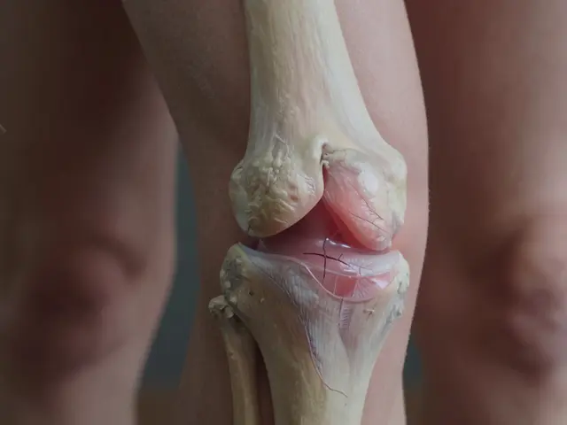 Proč mě bolí klouby? Příčiny bolesti a jak pomůže kolagen